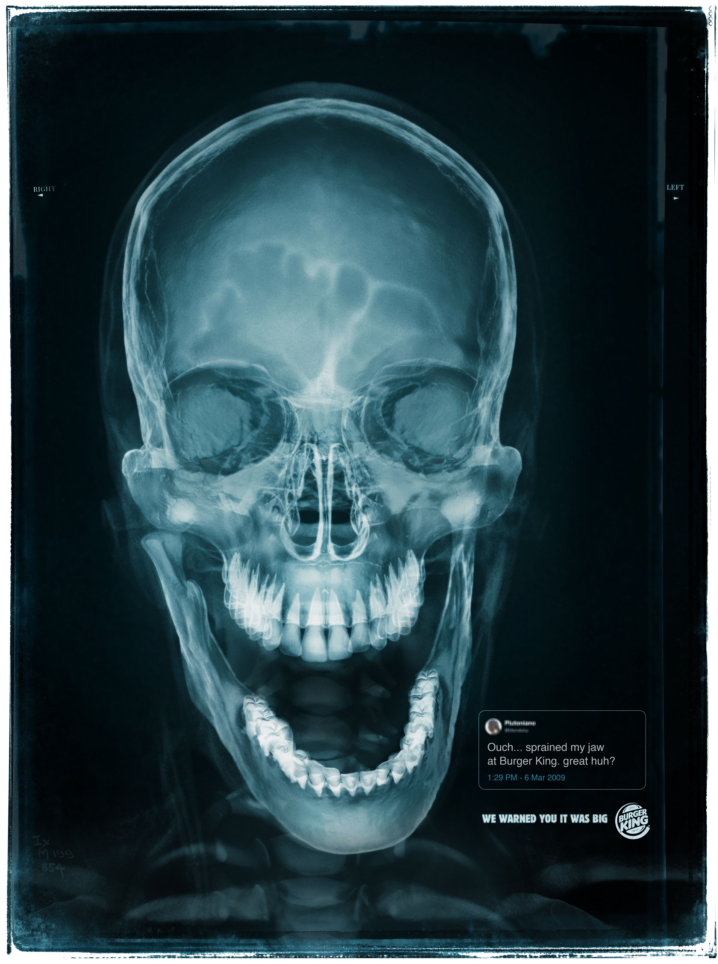 Burger King'den çenesini inciten müşterilerine: "Sizi uyarmıştık"