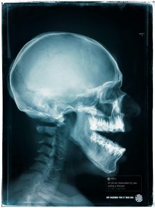 Burger King'den çenesini inciten müşterilerine: "Sizi uyarmıştık"