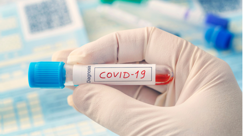ARED, sağlık çalışanları için koronavirüs kalkanı ürettiğini açıkladı